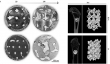 3D-gedrucktes Zinkgerüst könnte Knochendefektproblem lösen